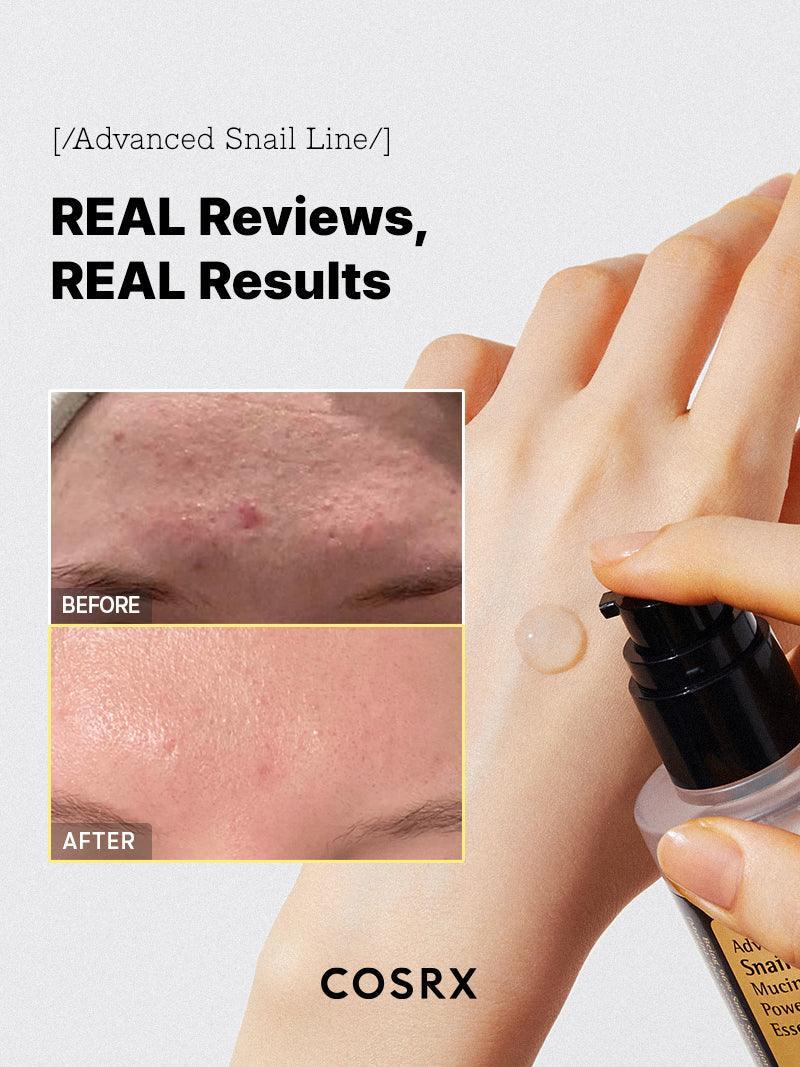 COSRX Snail Mucin Essence 100ml + Free Spatula – Hydrating Korean Skincare